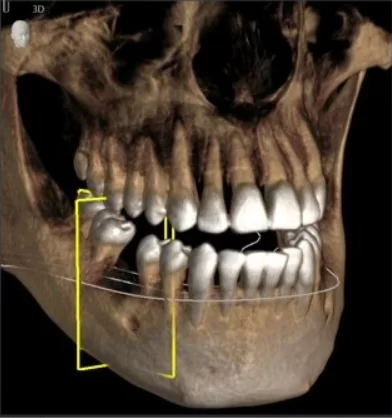 3d visualization provides a general understanding of the surgical plan