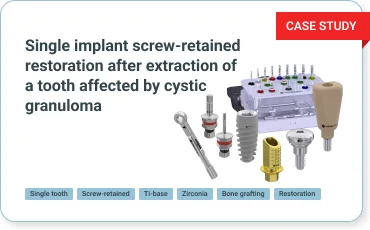 Uniqa Dental – Dental Implant Systems Manufacturer