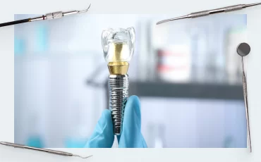 An Introduction to Implantology:<br></noscript> Dental Doctors’ Manual