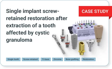 Single implant screw-retained restoration after extraction of a tooth affected by cystic granuloma