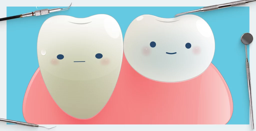 How to correct gingival recession