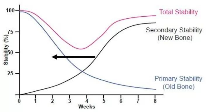 Primary, secondary, as well as total implant stability - the graph shows that weeks 3-5 are the most difficult weeks