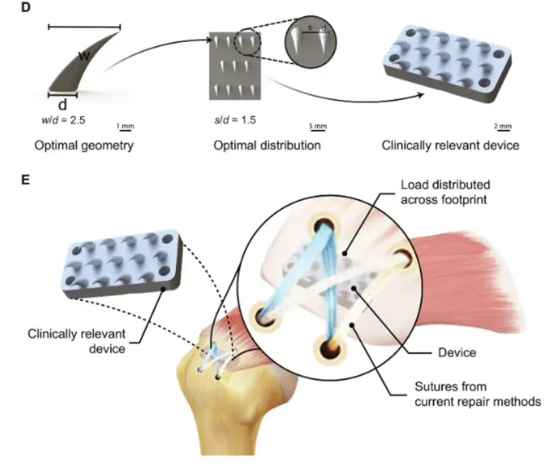 3d-printed biomimetic device for rotator cuff repair.