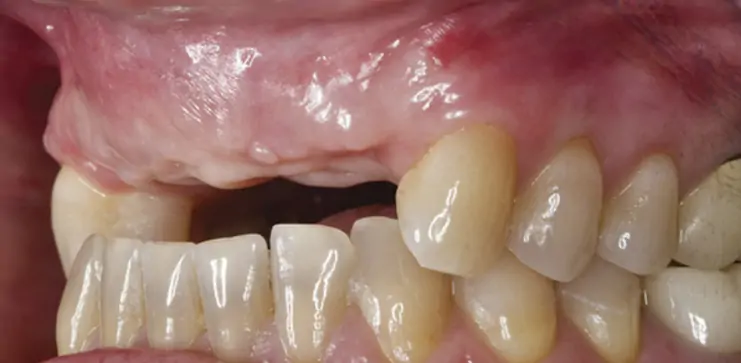 The patient’s initial clinical situation