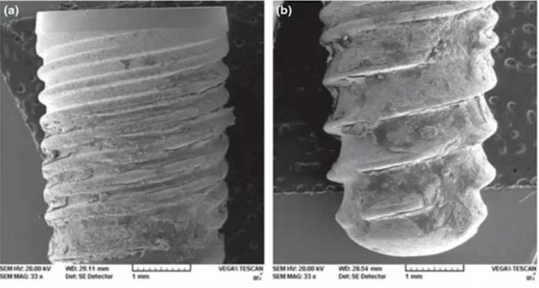 The surface of the implants was photographed using electron microscopy. Image - a) coronal part; image- b) apical part of the implant. Residual bone tissue can be observed on the entire surface of the implant (the implant was removed at week 4 of the experiment)