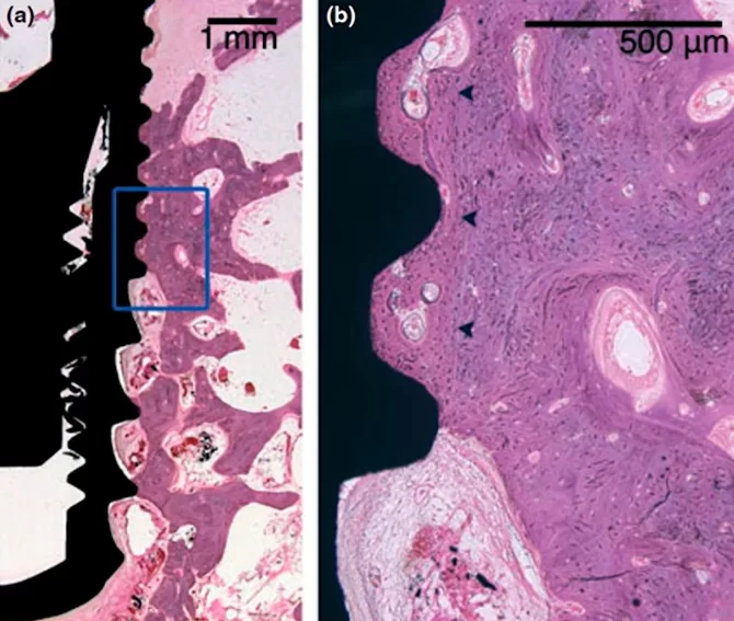 Microscopic section at the interface between bone tissue and the implant under high magnification; control group, 8 weeks without interventions