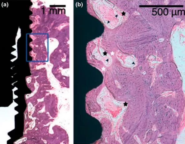 Microscopic section at the interface between bone tissue and the implant of the experimental group after mechanical disintegration at the 4th week of the experiment