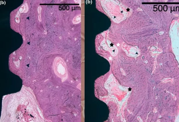 Comparison of tissue specimen from the control and experimental groups