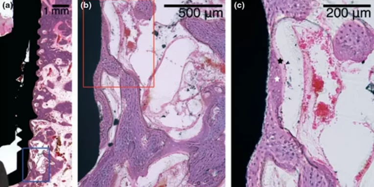 Microphotographs of bone tissue structure in the experimental group