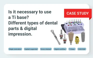 Is it necessary to use a Ti base? Different types of dental parts & digital impression