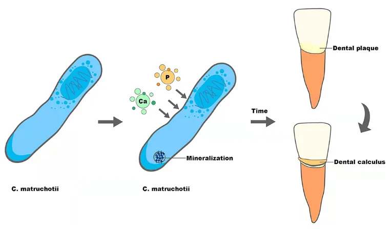 New findings on biofilm on teeth - what knowledge of the unusual mode of division of the bacterium corynebacterium matruchotii reveals