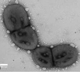 Porphyromonas gingivalis