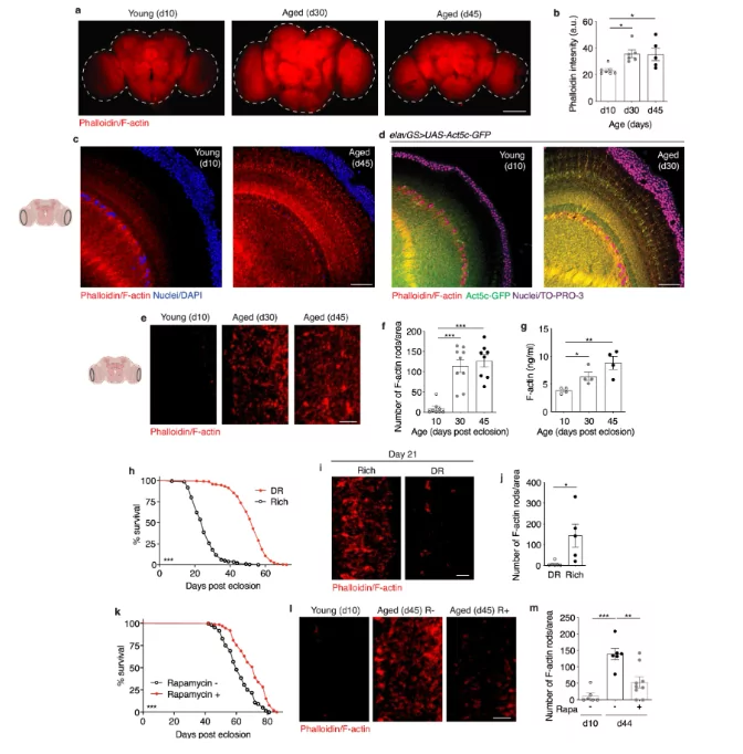 Brain aging and the fight against it: scientists have managed to stop the accumulation of F-actin protein in fruit flies (prospective study)