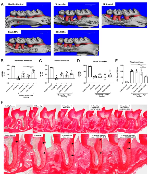 Pleasant “side effects” of immunotherapy are improved gum health: promising studies in mice