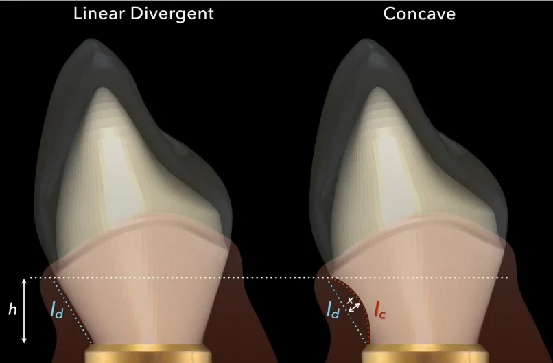 What abutment morphology is better for a gingival connection: linear divergent or concave? Randomized controlled trial of CAD/CAM abutments